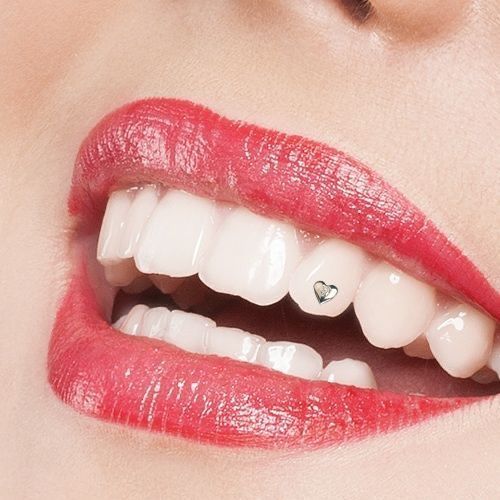 Có Nên đính đá Lên Răng Đính đá Có Gây Hại Không