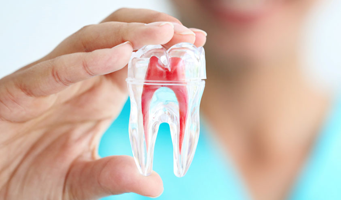 Điều Trị Tủy Răng – Nha Khoa Adent (1)