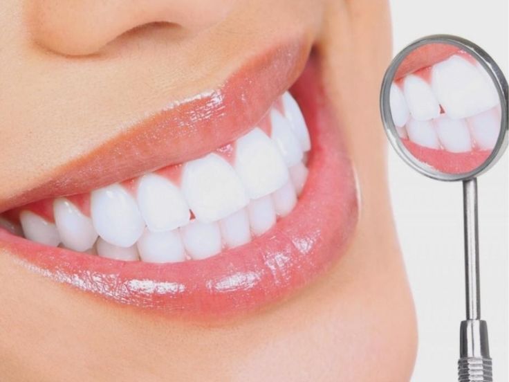 Bọc Răng Sứ Là Gì Có Những Loại Nào Và Cách Thực Hiện Chuẩn Nhất (1)