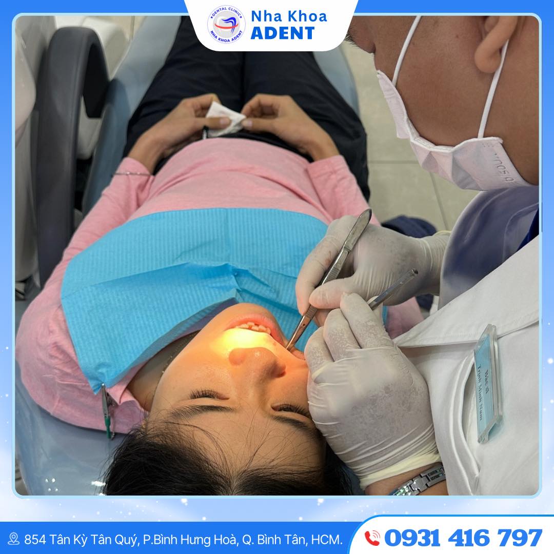 Bọc Răng Sứ Là Gì Có Những Loại Nào Và Cách Thực Hiện Chuẩn Nhất (6)