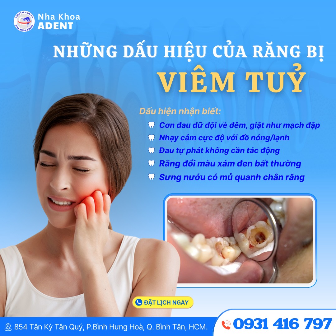 Dấu Hiệu Viêm Tủy Răng – Nhận Biết Sớm Để Không Hối Hận (12)
