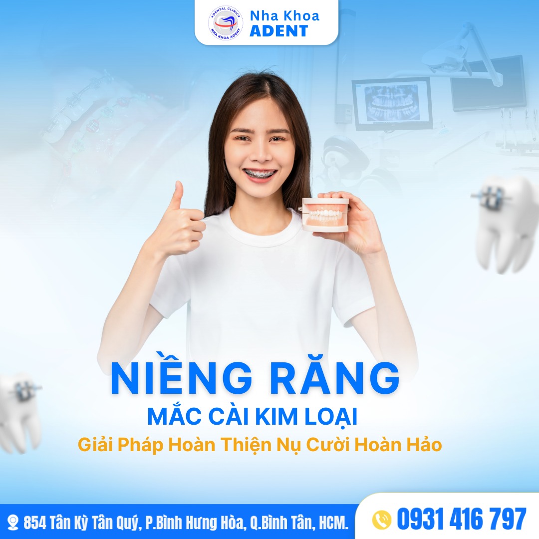 Niềng Răng Mắc Cài Kim Loại Phương Pháp, Chi Phí Và Quy Trình Điều Trị (3)