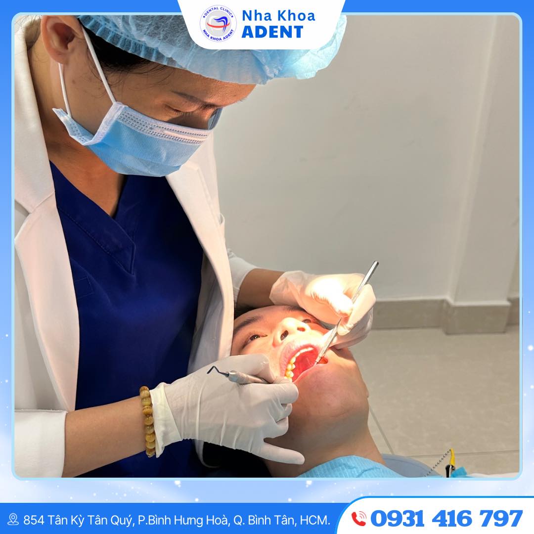 Răng Khôn Bị Sâu Nguyên Nhân, Tác Hại Và Giải Pháp Điều Trị Hiệu Quả (4)