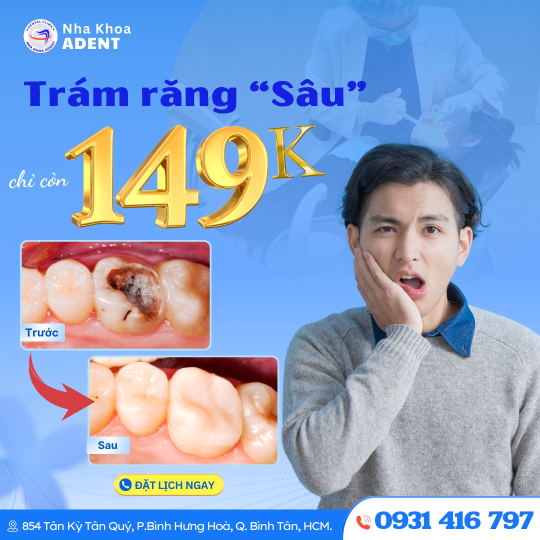 Trám Răng Sâu Nặng – Có Nên Hay Không Sự Thật Bạn Cần Biết Ngay! (1)