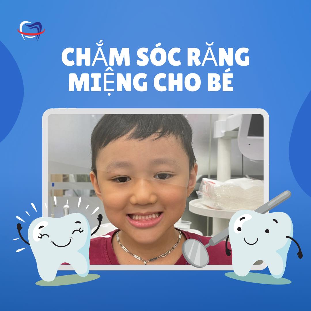Nhổ Răng Sữa Cho Trẻ