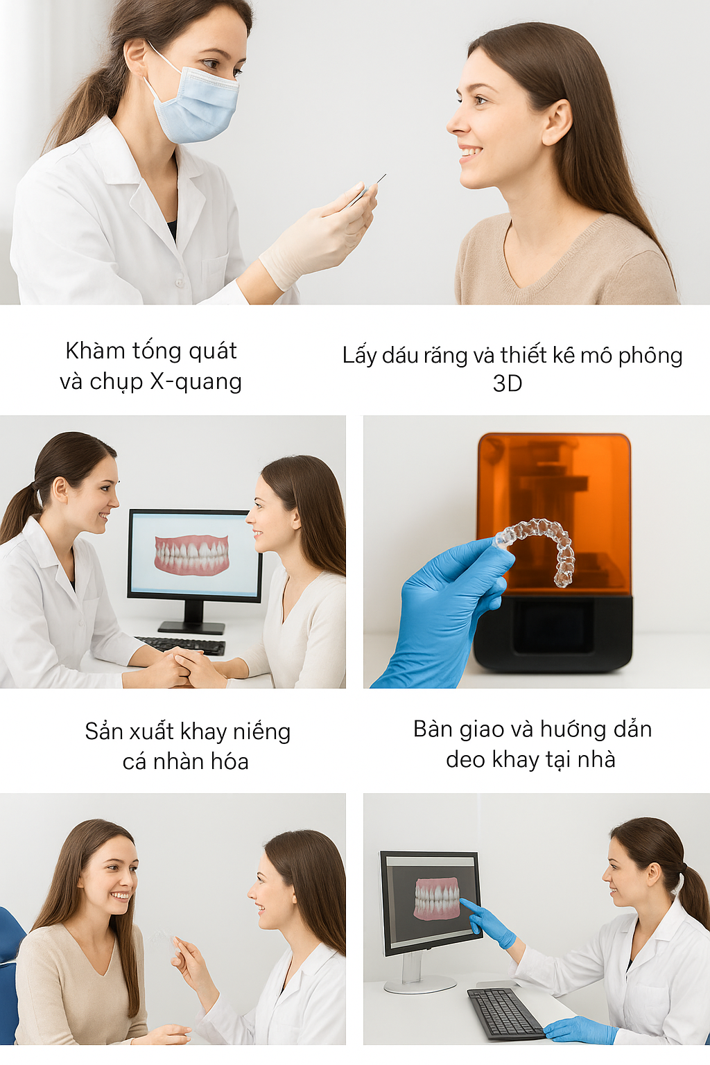 Niềng Răng Trong Suốt Mất Bao Lâu Chi Phí Bao Nhiêu (1)