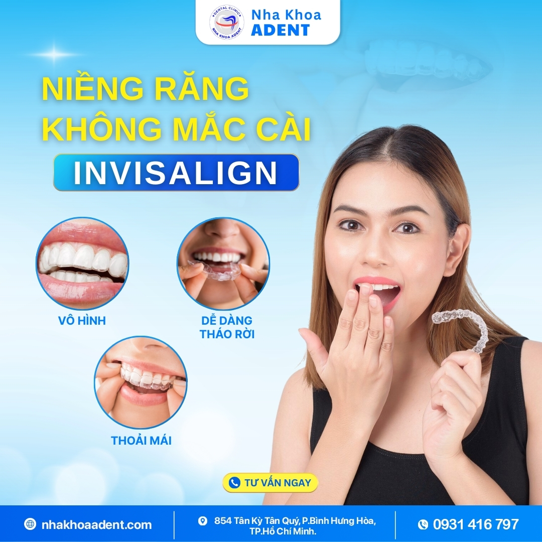 Niềng Răng Trong Suốt Mất Bao Lâu Chi Phí Bao Nhiêu