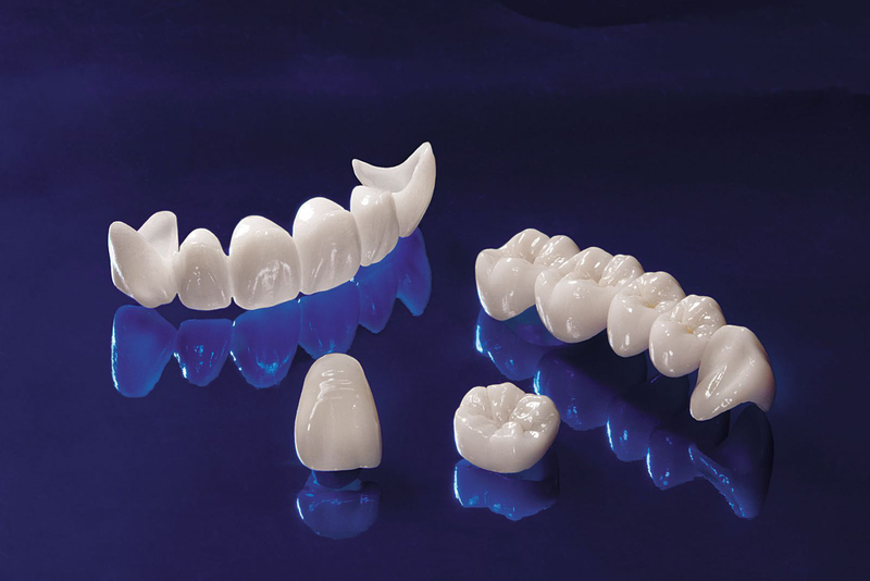 Phục Hình Răng Sứ Trên Implant Là Gì Quy Trình Và Những Điều Cần Biết (1)
