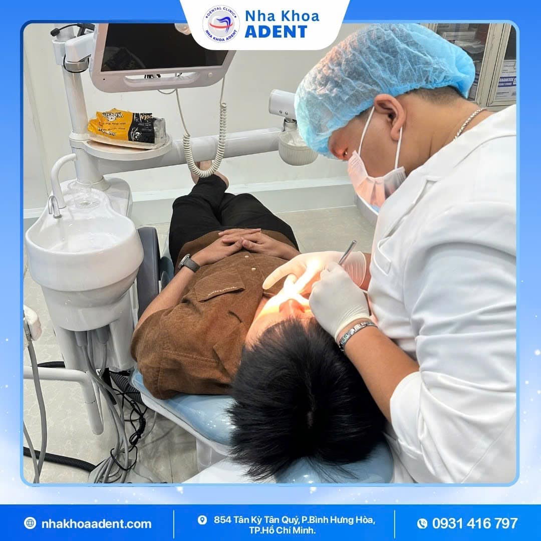 Cạo Vôi Răng Giá Bao Nhiêu