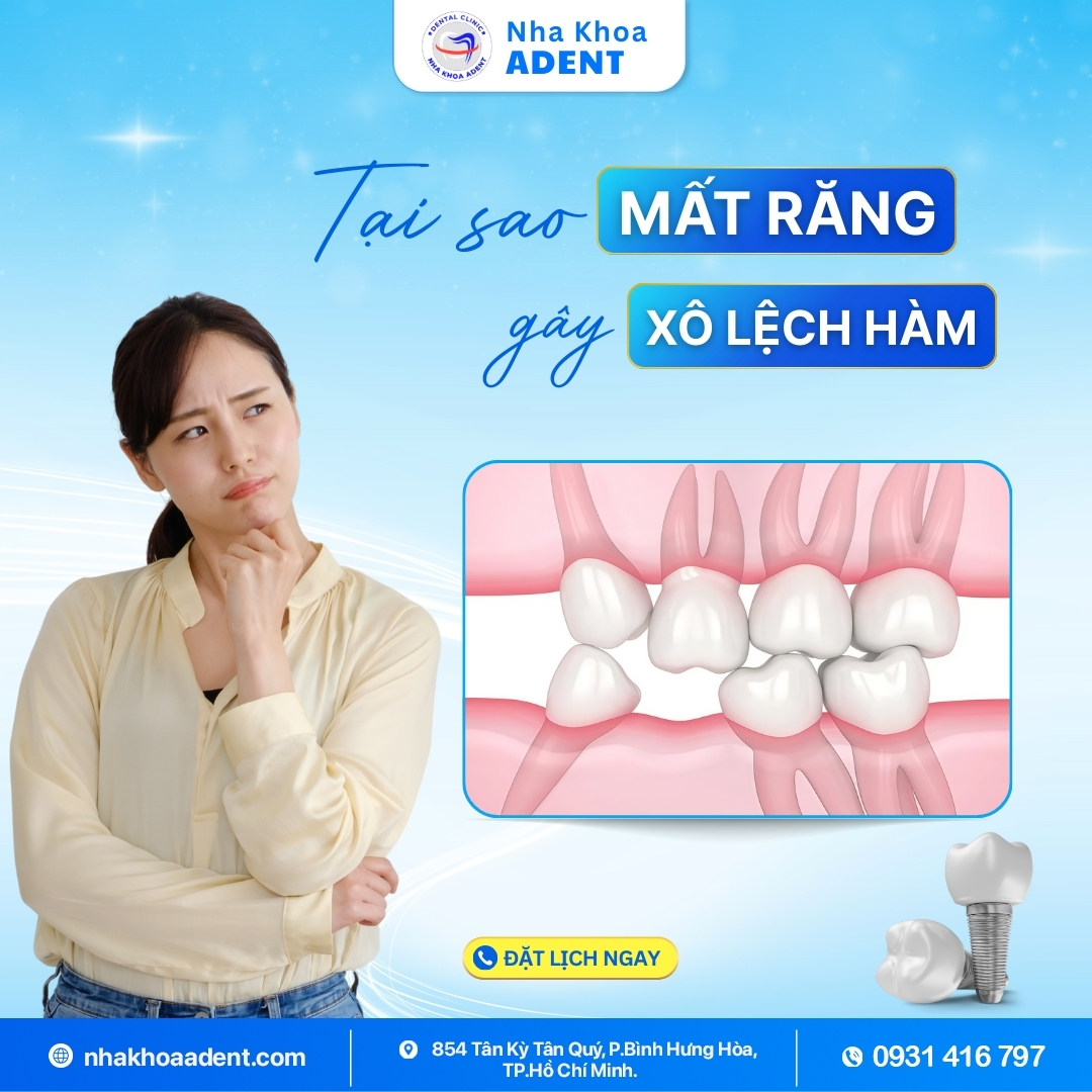 Mất Răng Có Nguy Hiểm Không Hậu Quả Và Giải Pháp Điều Trị