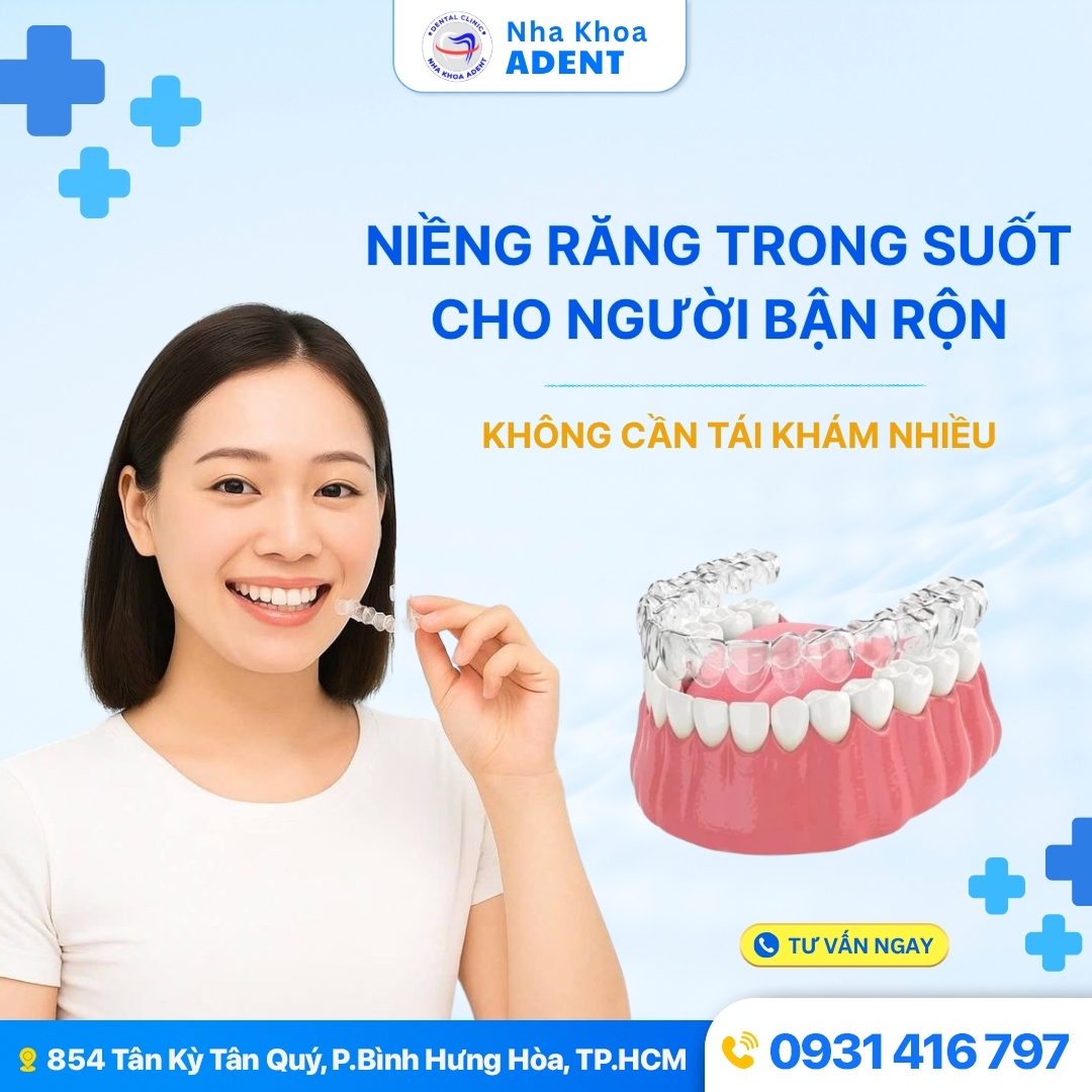 Niềng Răng Trong Suốt Mất Bao Lâu Chi Phí Bao Nhiêu
