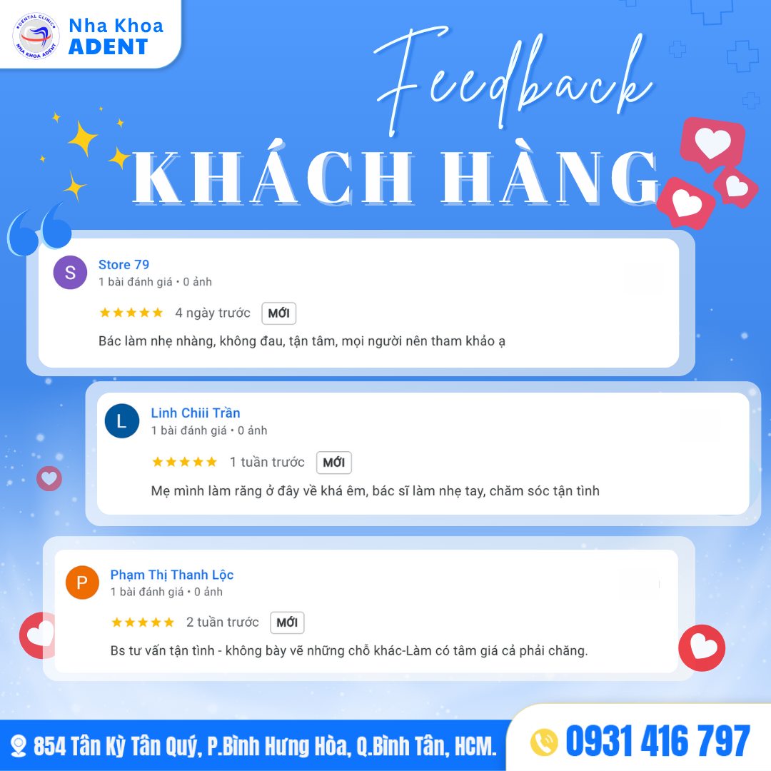 Niềng Răng Bao Nhiêu Tiền Bảng Giá Niềng Răng Chi Tiết 2025