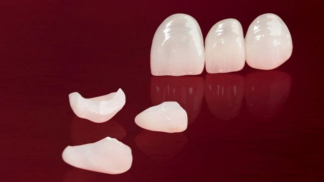 Phủ Răng Sứ Nano Là Gì Có Nên Lựa Chọn Không