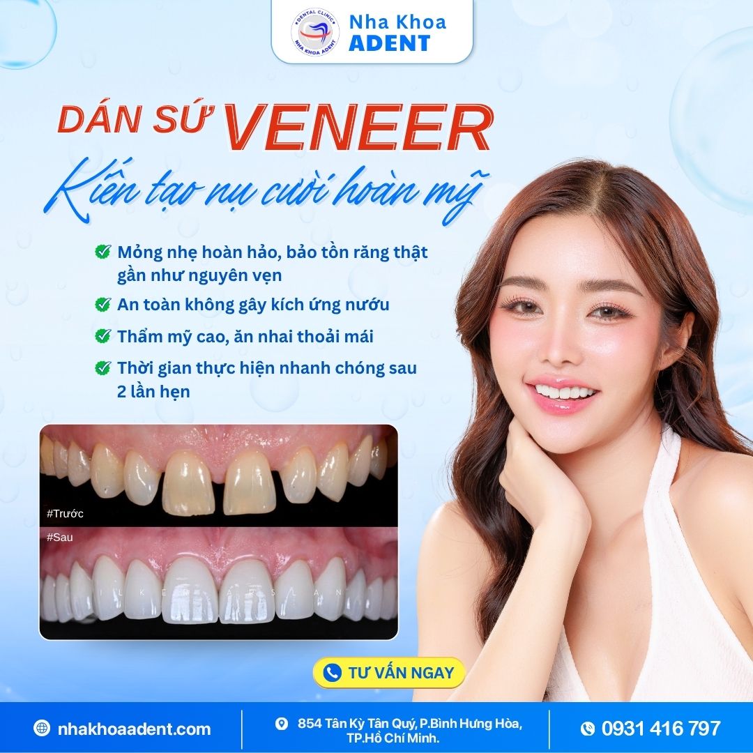 Phủ Răng Sứ Nano Là Gì Có Nên Lựa Chọn Không