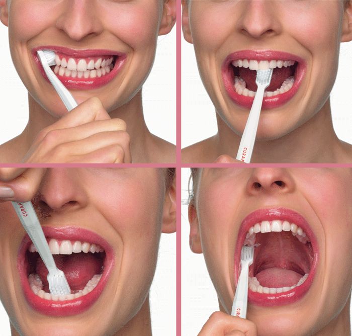 Chảy Máu Chân Răng Nguyên Nhân, Cách Điều Trị Và Phòng Ngừa