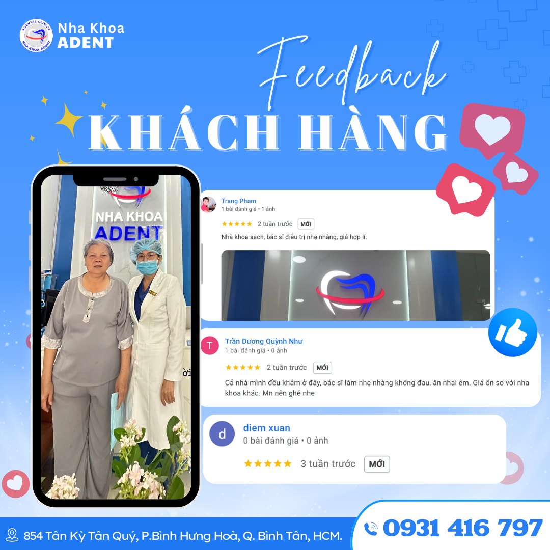 Trồng Răng Implant