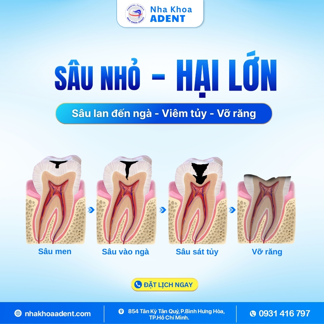 Tiêu Xương Hàm Là Gì Nguyên Nhân Và Cách Phòng Ngừa Hiệu Quả