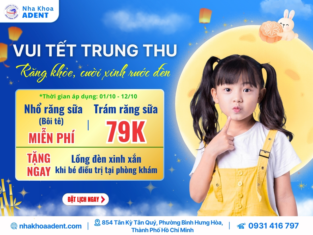 Vui Tết Trung Thu Cùng Nha Khoa Adent – Ưu Đãi Đặc Biệt