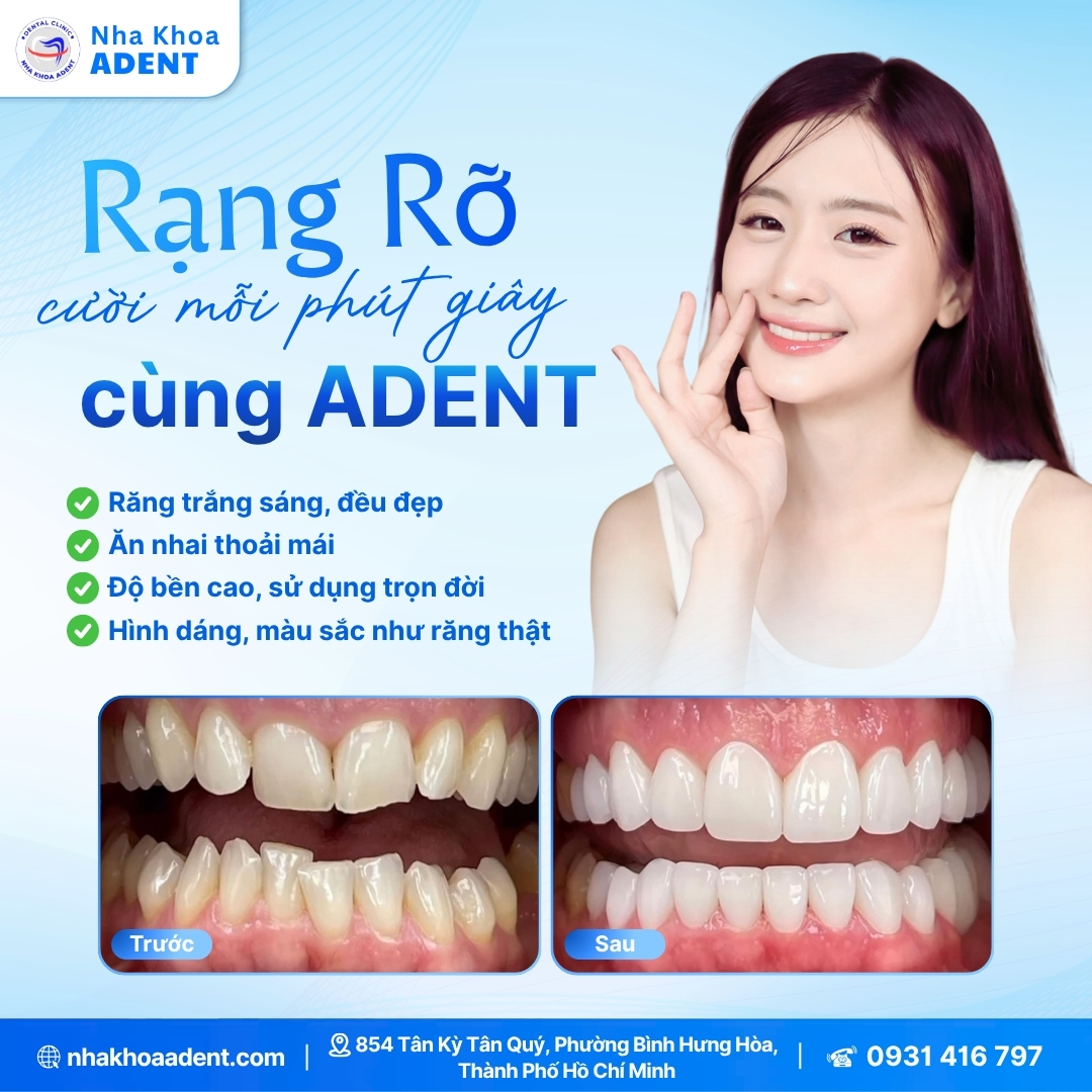 Răng Sứ Có Bị Ố Vàng Không Nguyên Nhân & Cách Khắc Phục Hiệu Quả (4)