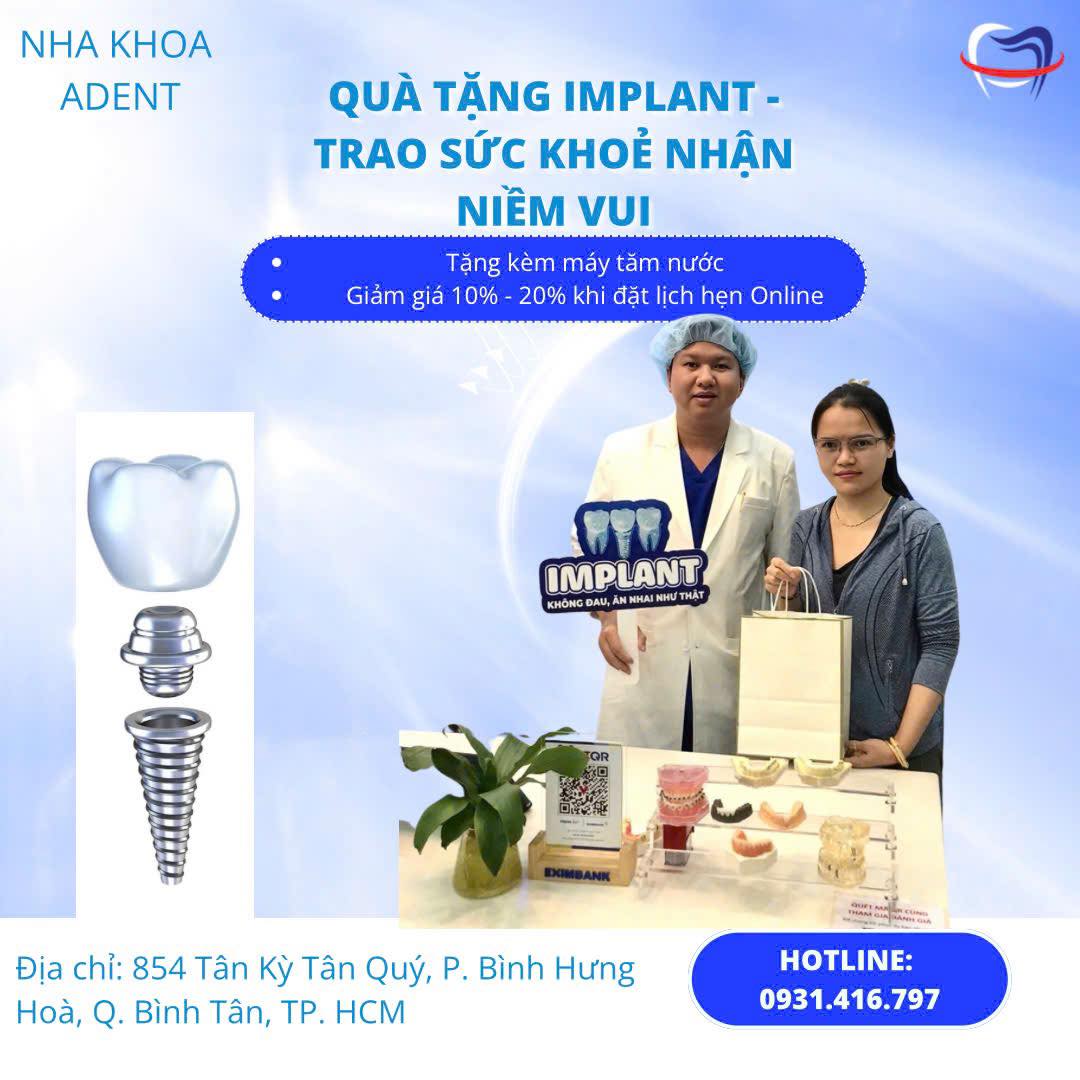 Trồng Răng Implant Uy Tín Bình Tân Tại Nha Khoa Adent