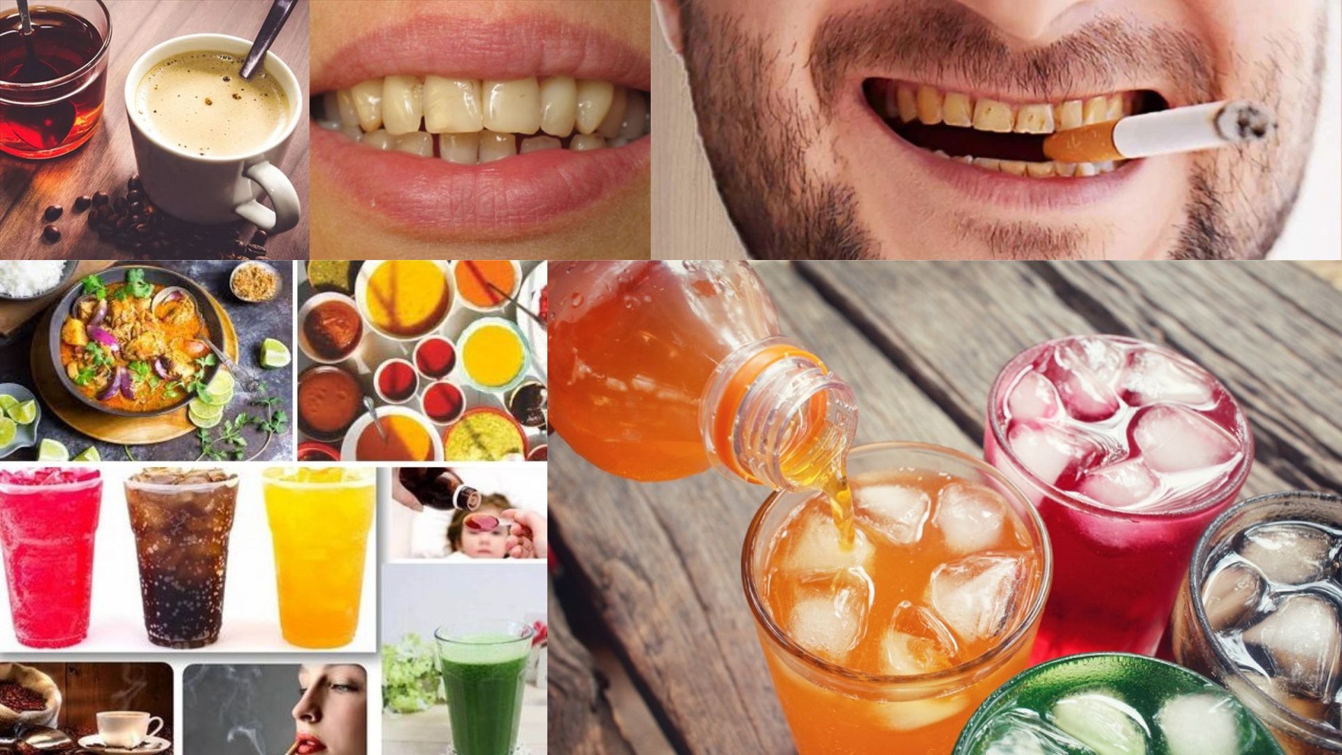 Công Nghệ Tẩy Trắng Răng Laser Whitening (2)