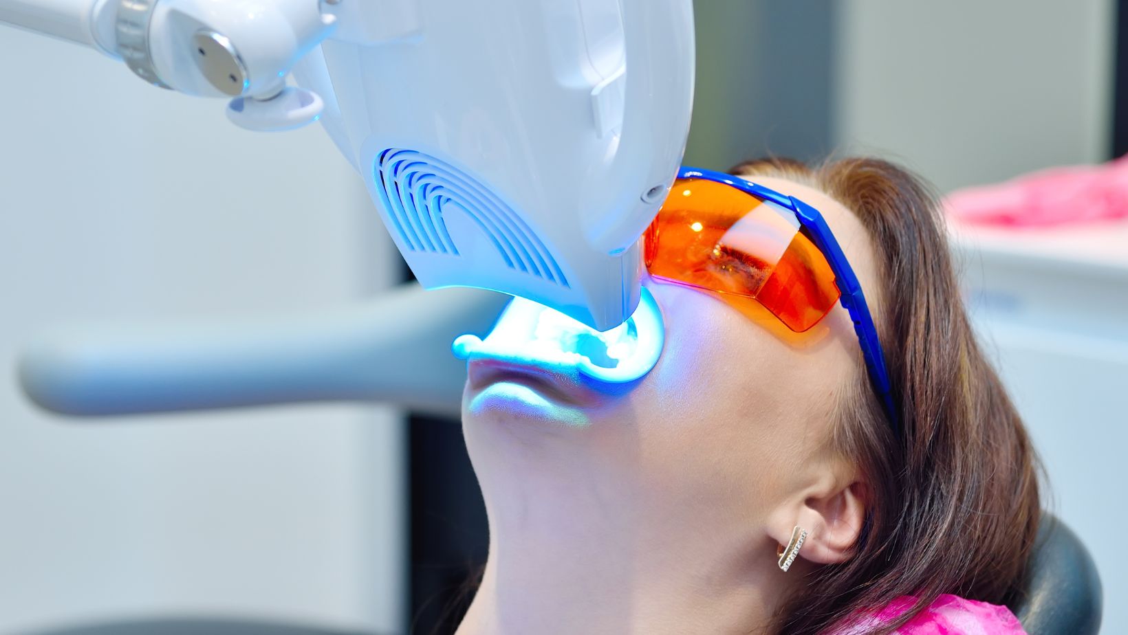 Công Nghệ Tẩy Trắng Răng Laser Whitening