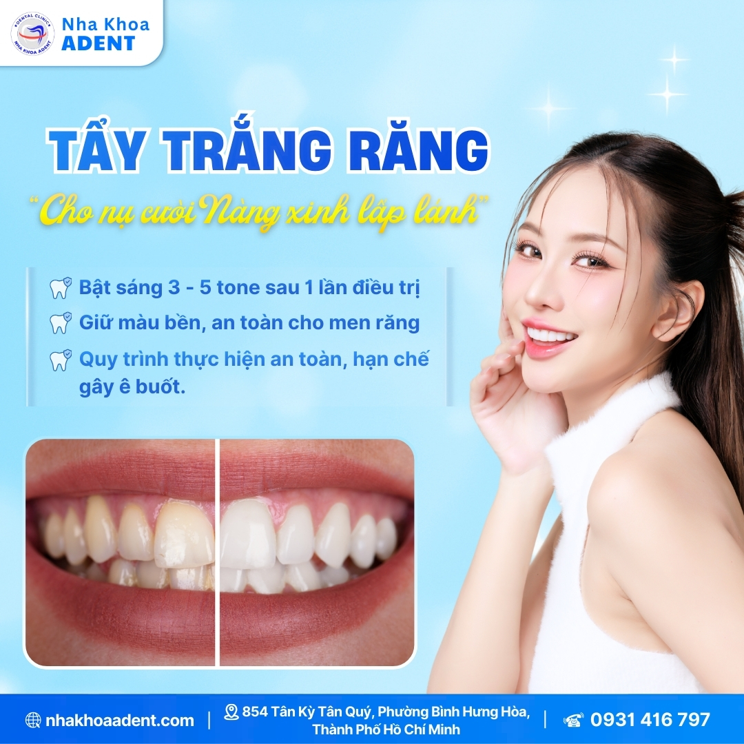 Công Nghệ Tẩy Trắng Răng Laser Whitening