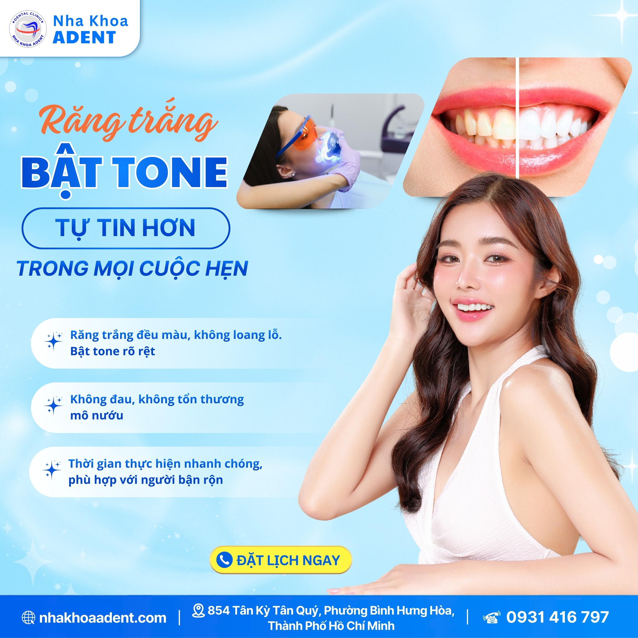 Công Nghệ Tẩy Trắng Răng Laser Whitening