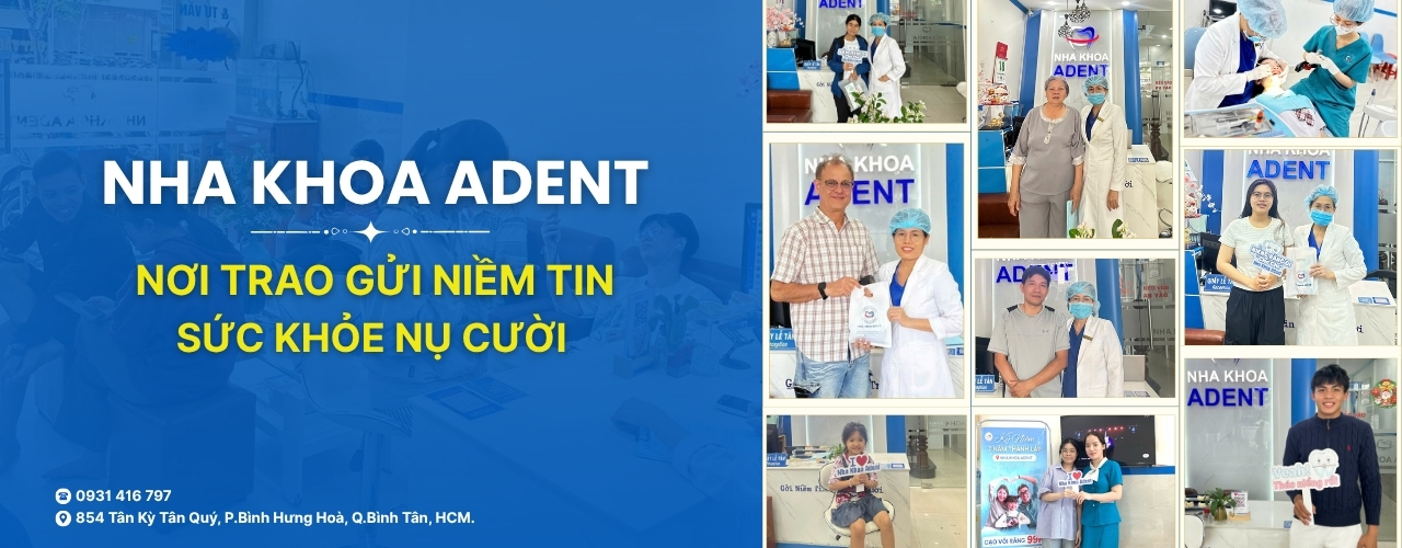 Ưu ĐÃi LÀm RĂng ĐÓn TẾt TẠi Nha Khoa Adent