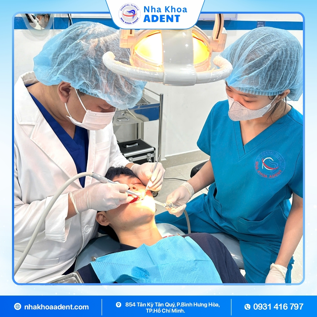 VỆ Sinh RĂng MiỆng ĐỊnh KỲ (4)