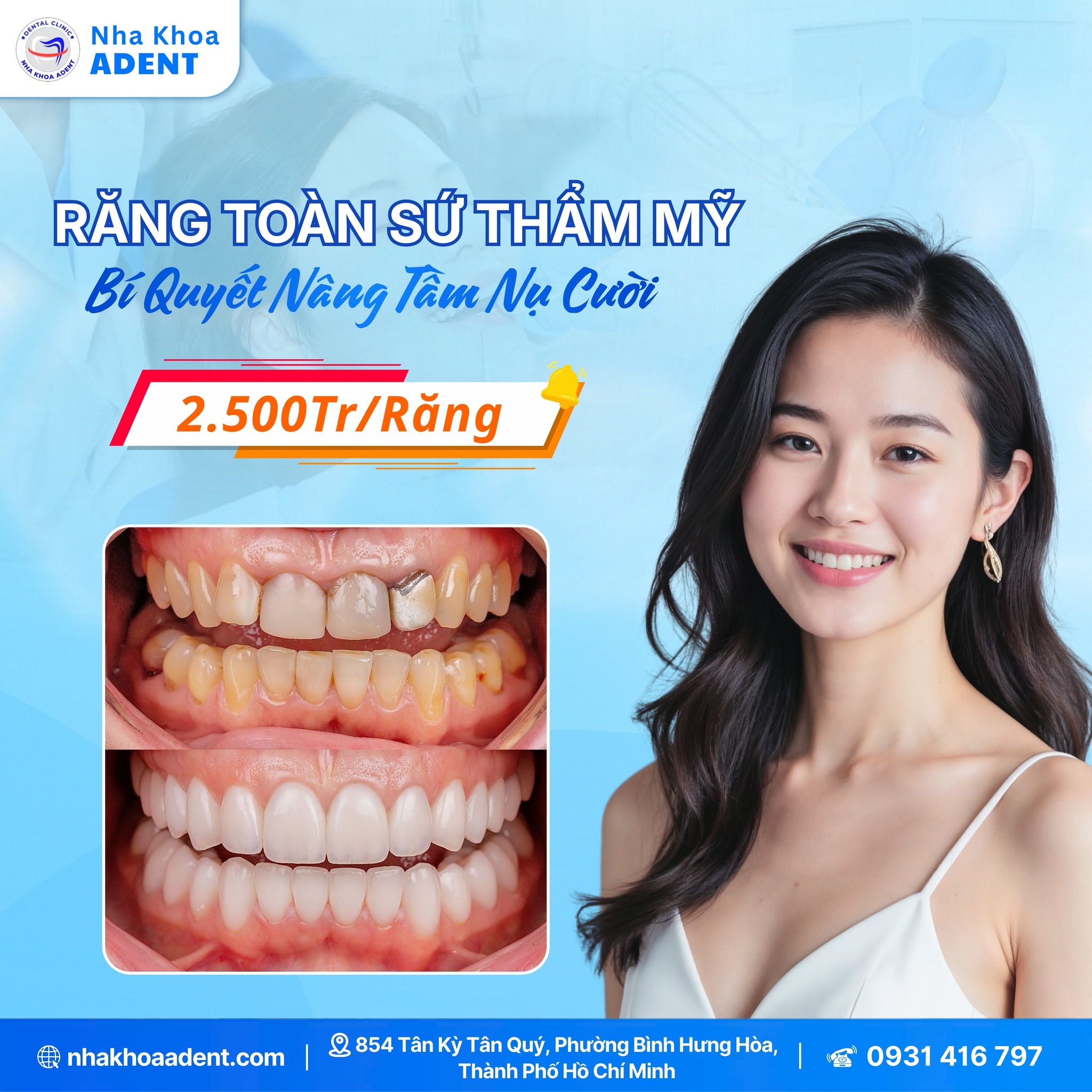 RĂng ToÀn SỨ LÀ GÌ CÓ NÊn BỌc RĂng ToÀn SỨ KhÔng