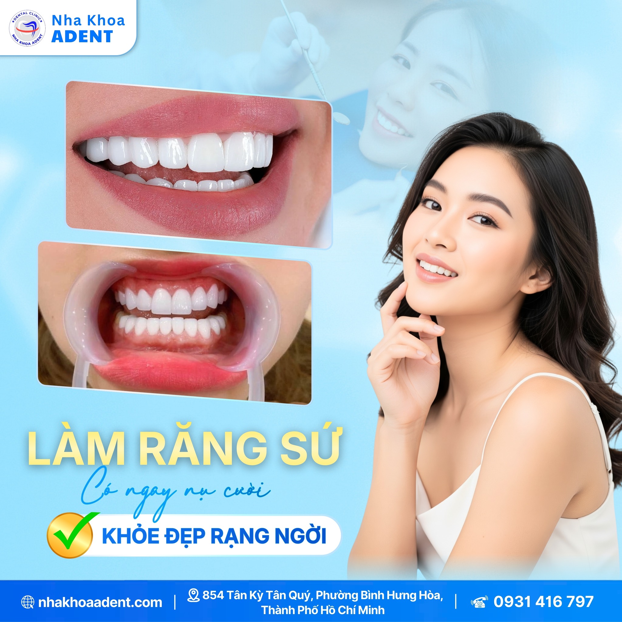 RĂng ToÀn SỨ LÀ GÌ CÓ NÊn BỌc RĂng ToÀn SỨ KhÔng