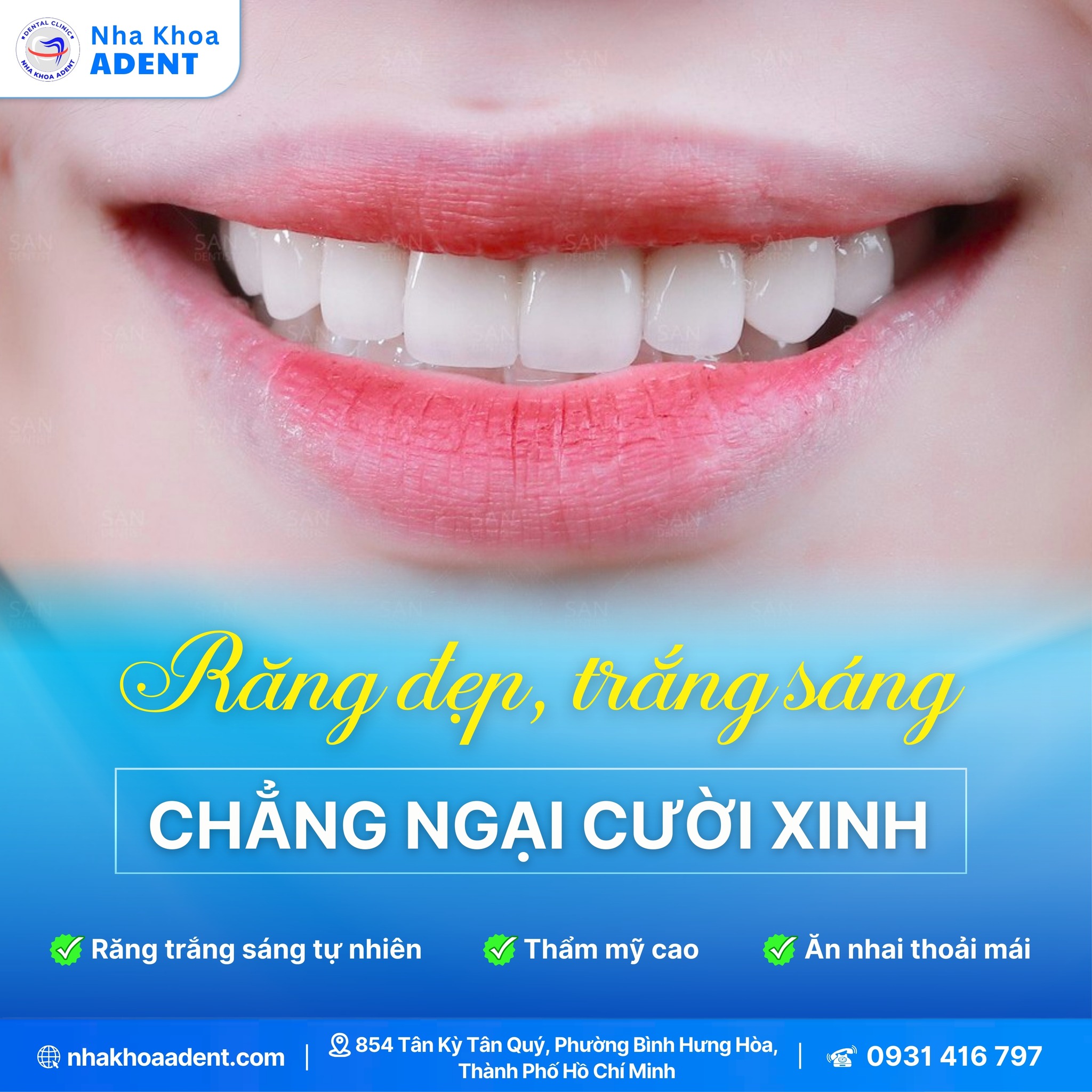 Ưu Và Nhược Điểm Bọc Răng Sứ – Giải Đáp Chi Tiết Từ Nha Khoa Adent (2)