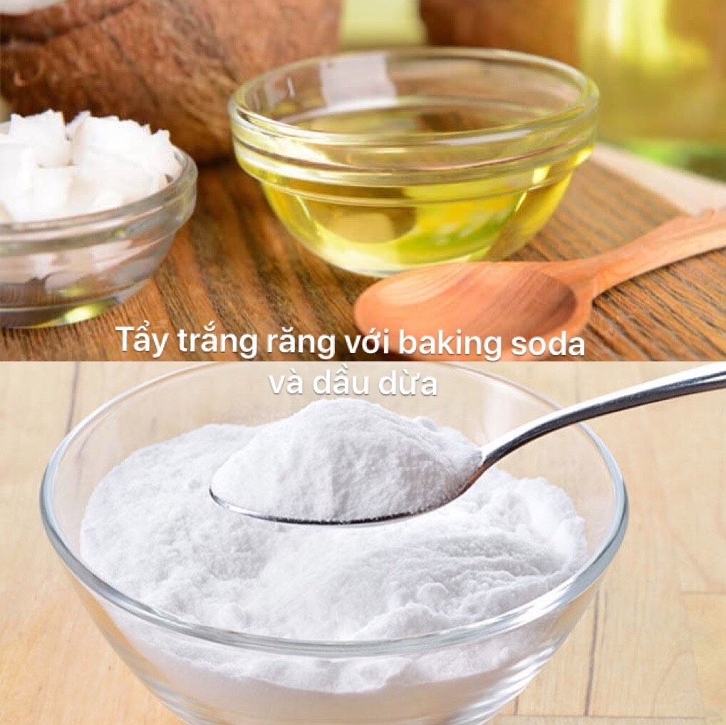 Răng Ố Vàng Nguyên Nhân Và Cách Khắc Phục Hiệu Quả