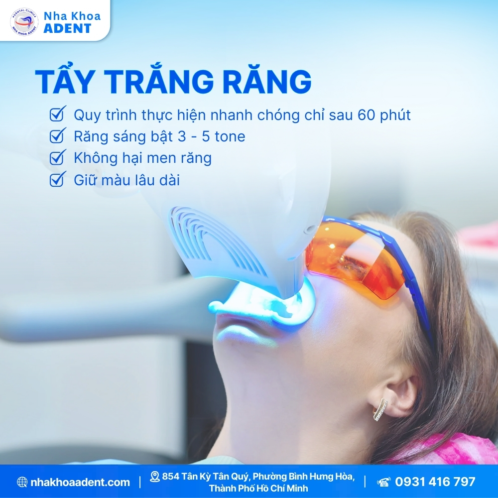 Răng Ố Vàng Nguyên Nhân Và Cách Khắc Phục Hiệu Quả