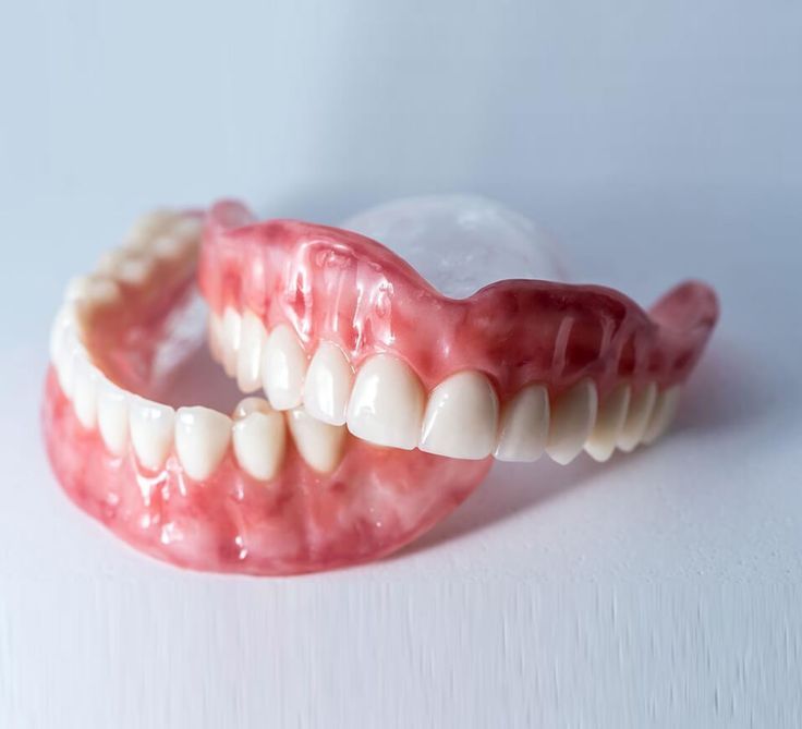 Trồng Răng Giả Tháo Lắp Tại Nha Khoa Adent