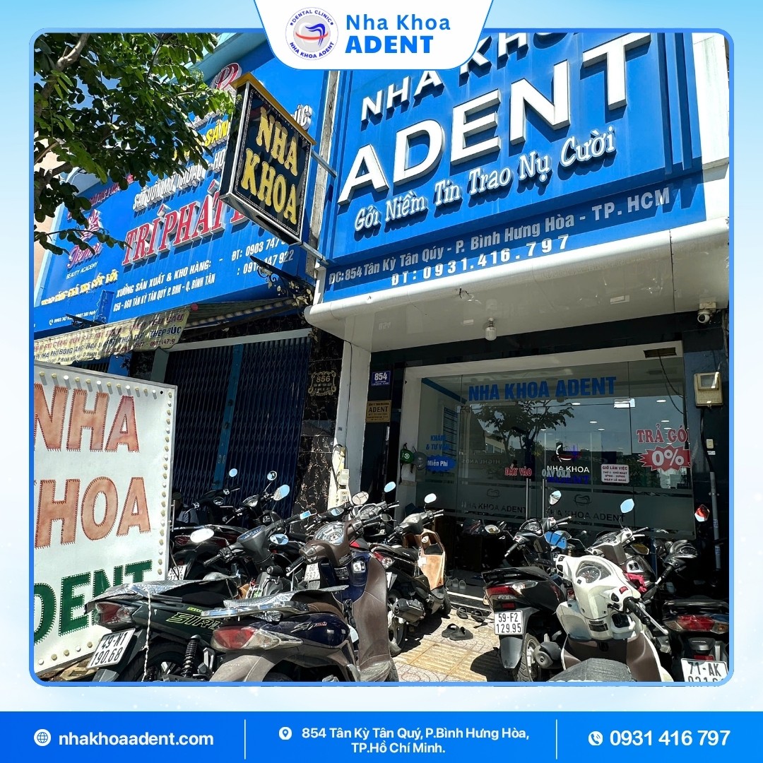 Trồng Răng Giả Tháo Lắp Tại Nha Khoa Adent