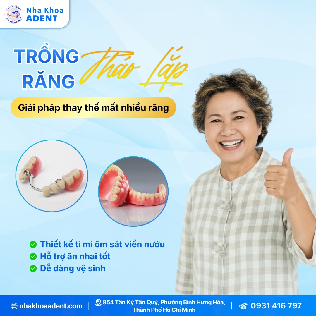 Trồng Răng Giả Tháo Lắp Tại Nha Khoa Adent