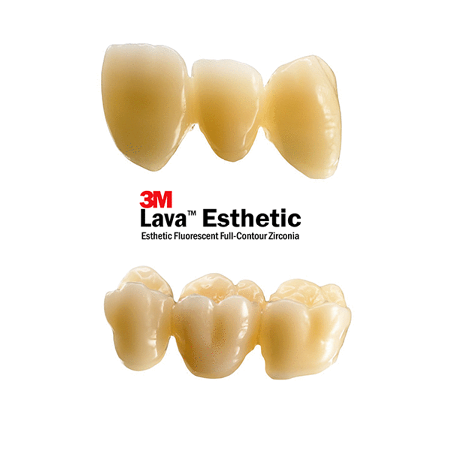 Răng Sứ Lava 3m – Ưu Điểm, Xuất Xứ Và Có Nên Lựa Chọn (2)